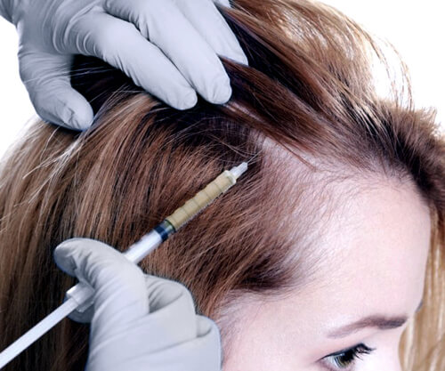 FUE Hair Transplant - Comfortable & Minimal Downtime