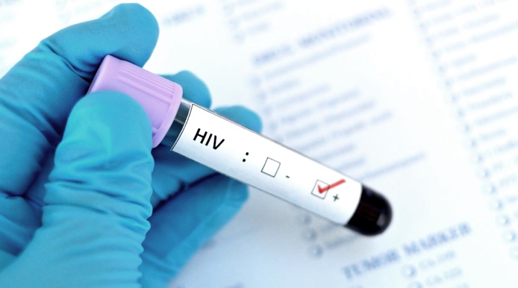 Protect Yourself With Hiv Pep 1790