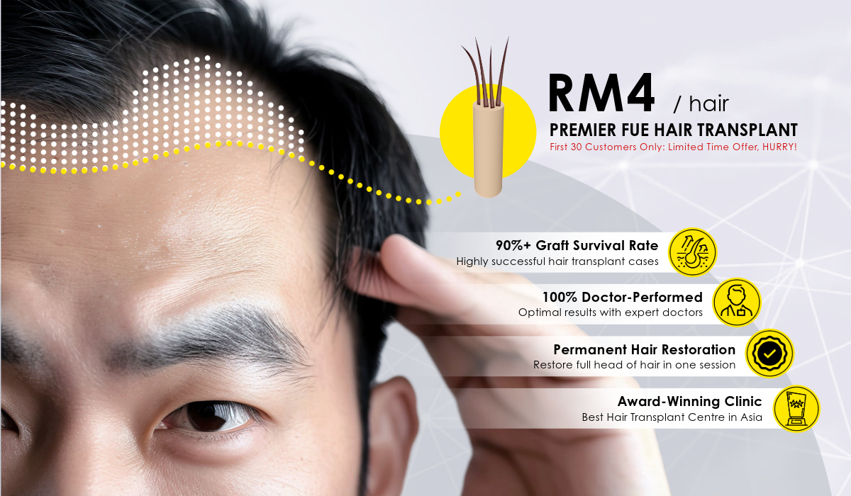 RM4/HAIR FUE HAIR TRANSPLANT PROMO