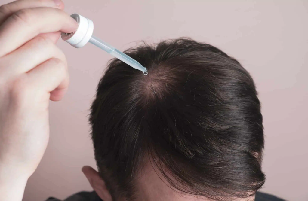 hair loss vitamin