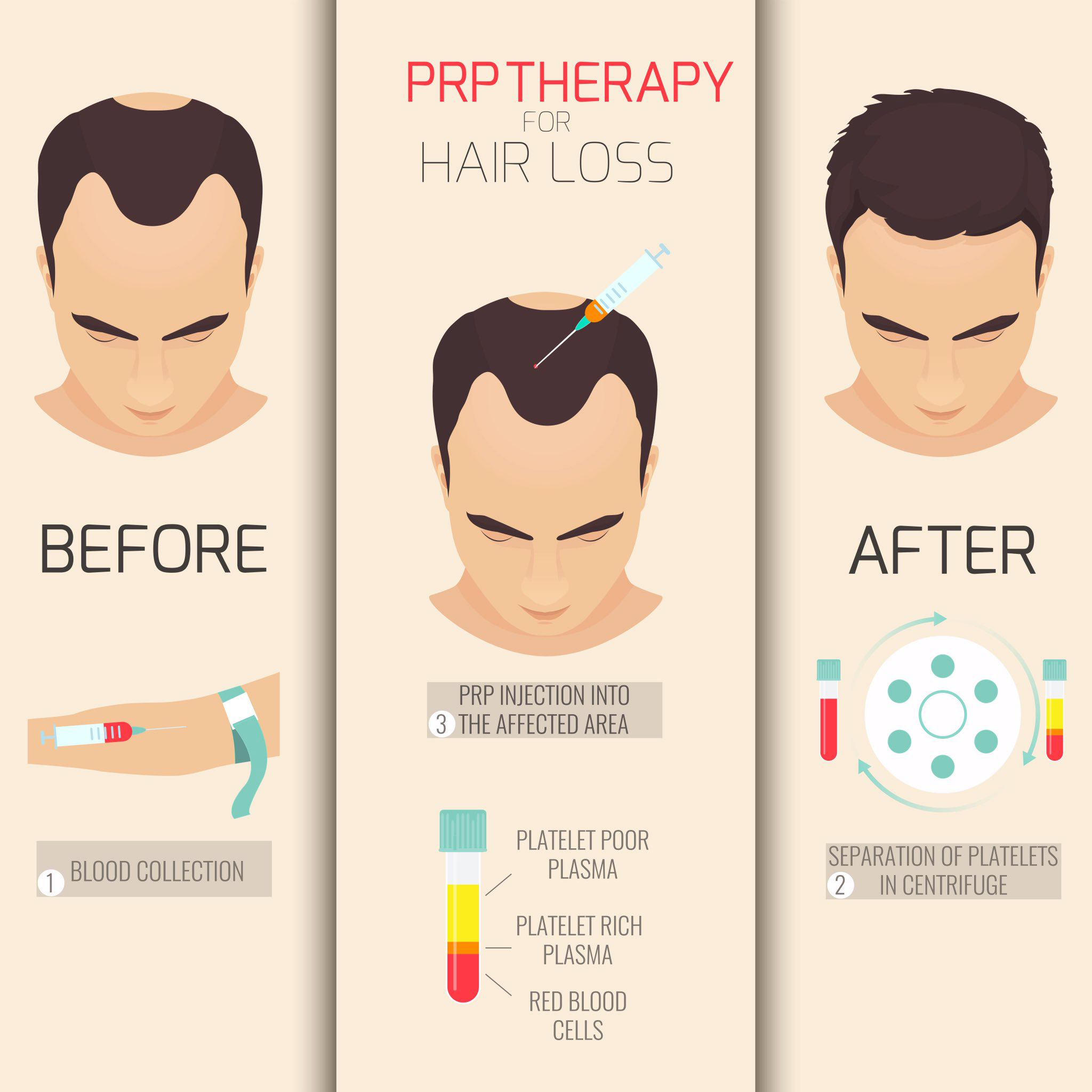 prp hair treatment before and after